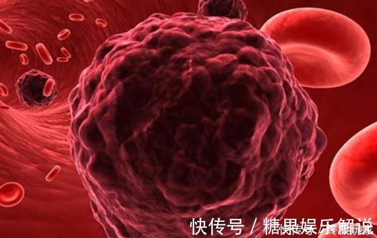 复发|肿瘤手术后复发的几率是多少?做好4件事,或许有助降低复发率