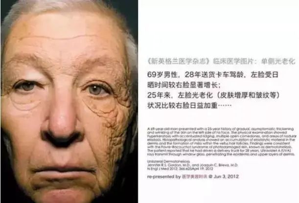 spf|今年夏天那么晒,你的防晒做对了?