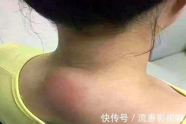 午睡|寿命短的人，或有两处“凸出”，无论男女都一样，快来对照一下