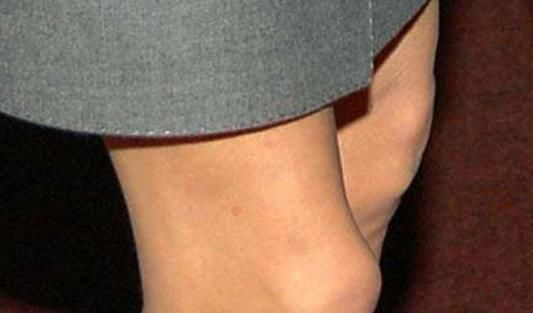 膝盖|当女性下半身出现3个“异常”时，别不承认，你已经衰老了！