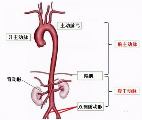 旋风|旋风杀手，主动脉夹层是什么病？