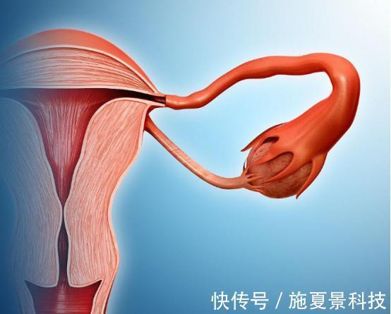 宫颈癌|宫颈癌也不是“说来就来”的,2个“帮凶”请你注意,3招阻止