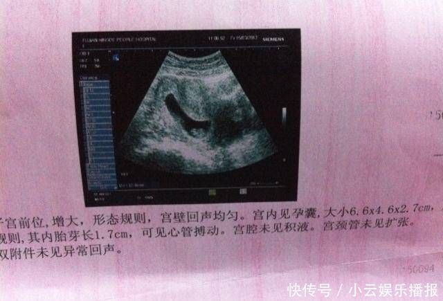 怀孕|怀孕后，如果怀孕的妈妈有这三场表演，也许她是肚子里的小公主，提前恭喜