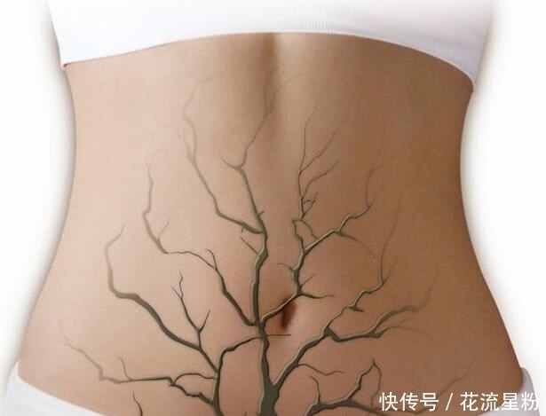 妇科病|子宫垃圾的“福音”，来大姨妈时多吃点，子宫干净，妇科病不来扰