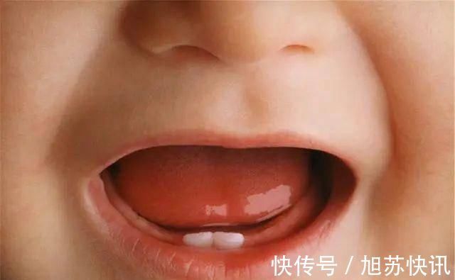 口腔|宝宝出牙的时间、症状表现以及注意事项，一篇讲清，宝妈要了解