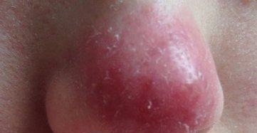 医院|身上出现这6个信号,尽快去医院检查一次肝功能,晚了就后悔吧