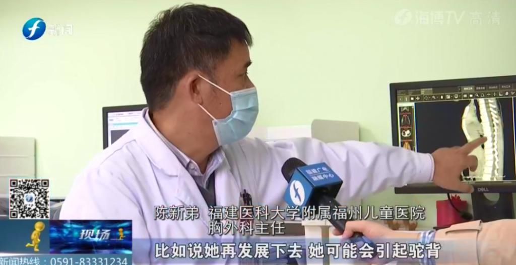  女童|5岁女童＂漏斗胸＂凹陷紧邻心脏，离脊椎不足5厘米！
