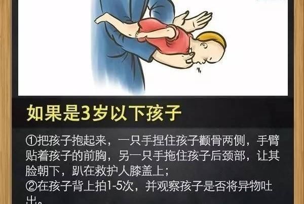 一命|“去医院就晚了!”11岁儿子被卡喉,宝妈2个“果断”救孩子一命