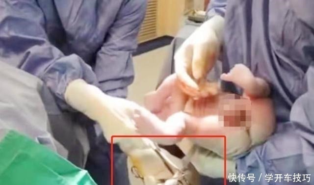 生娃|宝宝出生后被带走十几分钟,这段时间经历了什么组图带你看真相!