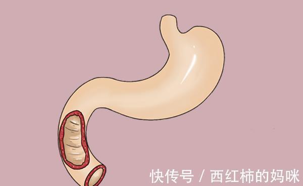 调理|孩子不爱吃饭，健脾消食是关键，分清楚情况，调理起来或很简单