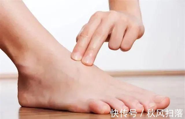 鸡蛋|血脂超标的人,鸡蛋可以吃,但这几类食物,请停止食用,切莫贪嘴