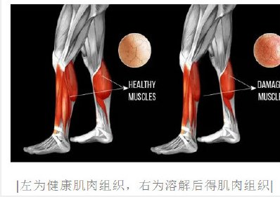 运动|平时常运动的小伙跑步时突然昏迷进ICU！医生：这病致死率达50%