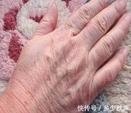 双手|天气一冷,手就容易皱巴巴?教你一招,让双手变得白嫩又光滑