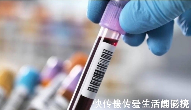 头晕头痛|大妈血脂从6.4降至1.6,医生:2物是血液“净化器”,可敞开吃