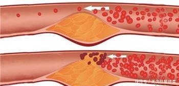 食物|3种食物, 让血管越吃越干净