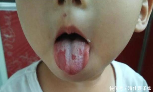 免疫系统|宝宝积食不吃饭，妈妈用2个水果通通解决，还有助于长个子！