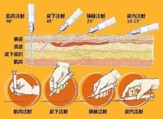 免疫|为什么一定要“打”疫苗？“吃”不好吗？