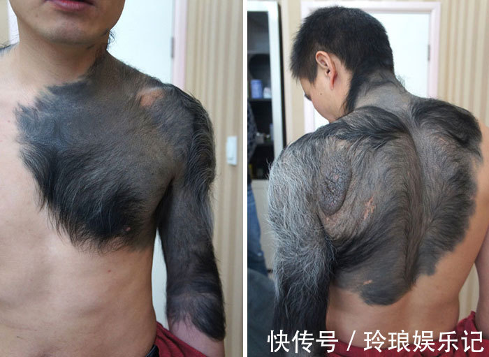 脚趾|19个“被上帝挑选过”的特殊基因人类,怎么梳都不整齐的头发