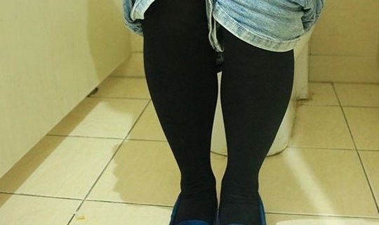 内裤上有黄色,怎么洗都洗不掉,是什么原因?答案或许超乎你想象