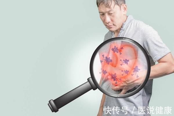 胃部|胃癌患者,除了治疗,这5个措施也要重视,才能事半功倍