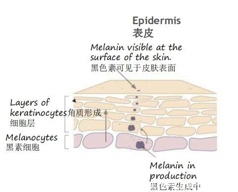 黄褐斑|黄褐斑小心越治越“黄”,在家3种食物冲水喝,轻松祛斑美白