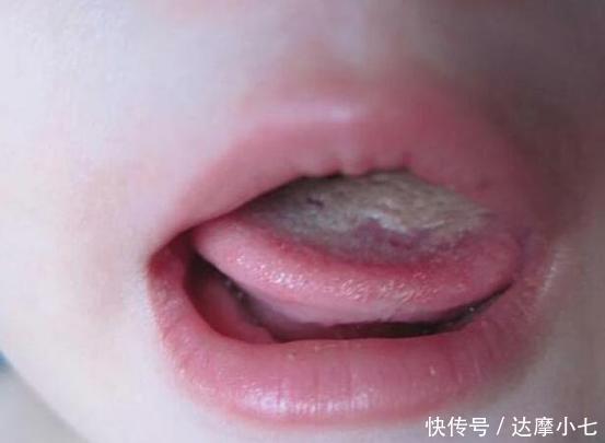 男童|吃1次等于吃10个塑料袋,7岁男童积食不长个,只因“毒晚餐”