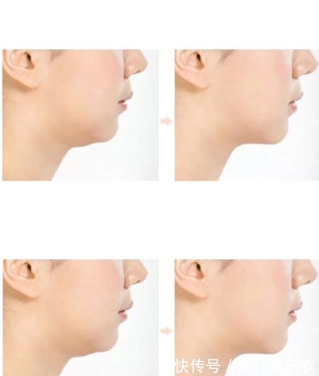 乔欣都那么瘦了怎么还有双下巴!