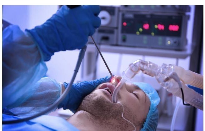 鼻炎|以为是鼻炎,结果查出来鼻息肉!会不会癌变,要不要手术切掉