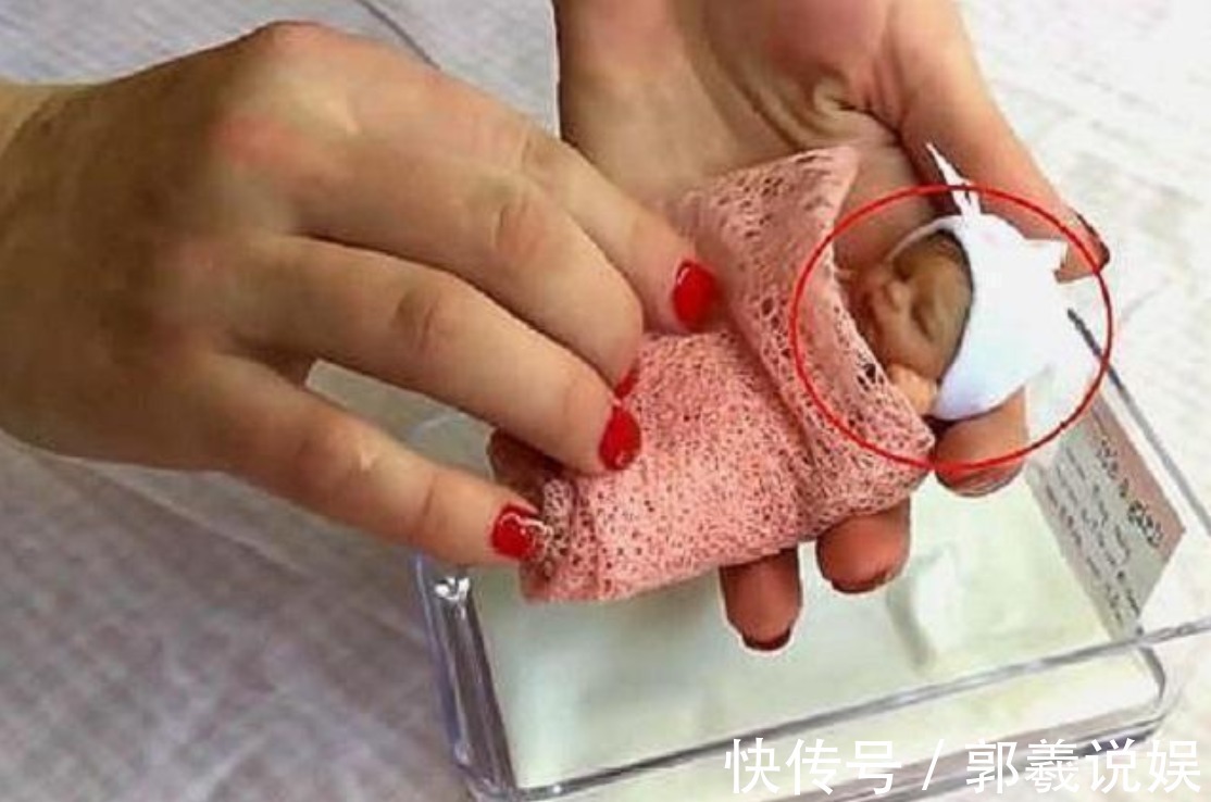 宝宝|14年前,出生时仅0.56斤的“世界最小婴儿”,现在过得好吗