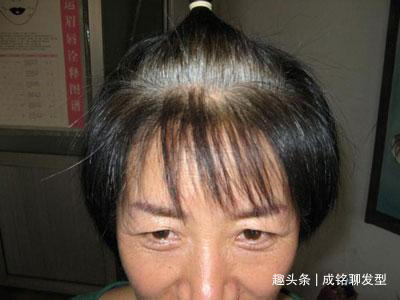 头皮 经常染发的老年人,要养成这三个养护好习惯,头皮健康不伤发