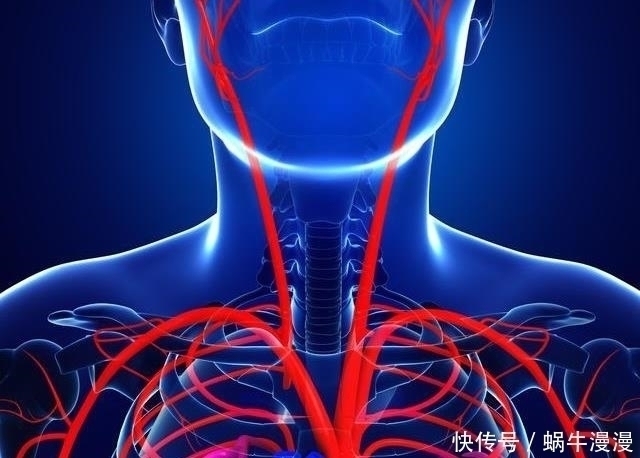 食物|颈动脉一通，脑梗无踪影，学会吃2类食物，早疏通，早预防