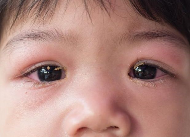 大夫|14岁孩子1年长高18公分,儿科大夫:坚持这个好习惯,个子不发愁