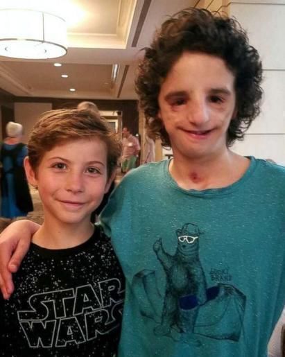 孩子|“鸟脸”妈妈不顾劝阻坚持生二胎,二宝顺利出生后,全家人都嫌弃