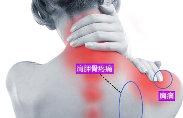 治疗|最容易忽视的颈肩痛，是颈椎病？4种方法鉴别、9种治疗措施纠正