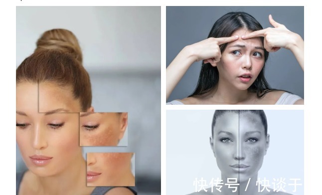 肌肤|肌肤屏障受损,多数因为护肤习惯差!