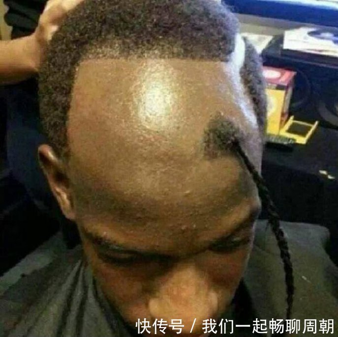 两边|最失败发型:卷毛在中间,刘海挂两边哈哈哈,你是男是女呀?