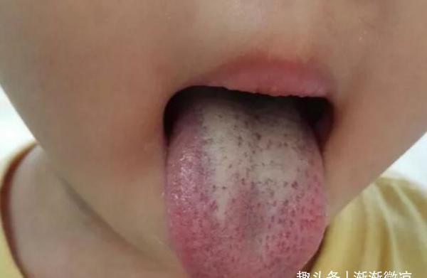 积食|六岁男孩个矮只怪“毒早餐”,积食不长个,吃一次等于10碗地沟油