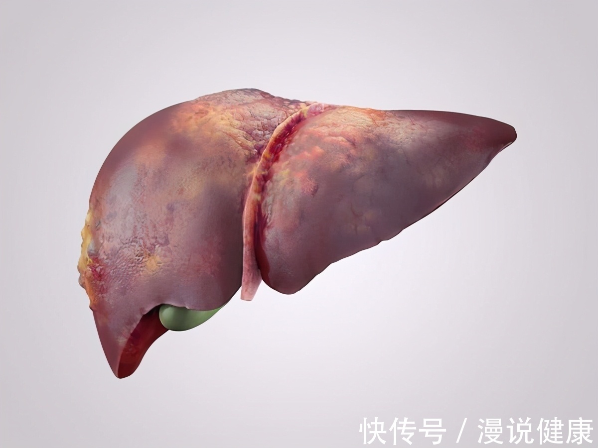 酒精|滴酒不沾就不会患肝硬化?提醒:除了酒精,这些因素同样也是诱因