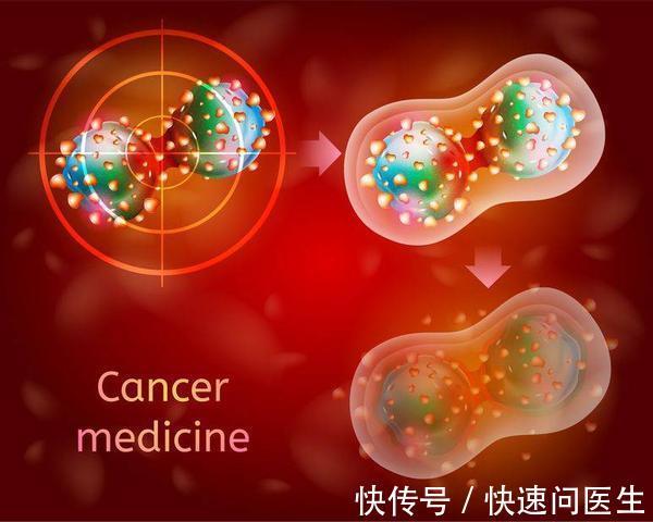 转移|癌症易转移?想要防止复发转移,请记住以下5点