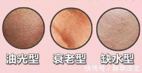 果酸|护肤品能解决毛孔粗大问题吗?如何真正解决毛孔粗大的问题呢?