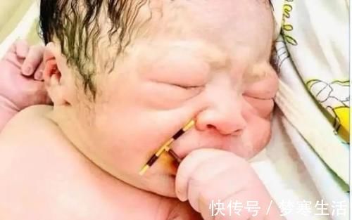 生育|新生儿手拽避孕环顺产出生,我命由我不由天,谁也阻挡不了我来这个世界
