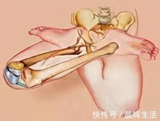 瑜伽|膝盖寿命有限,一定要学会在瑜伽及日常生活中保护膝盖