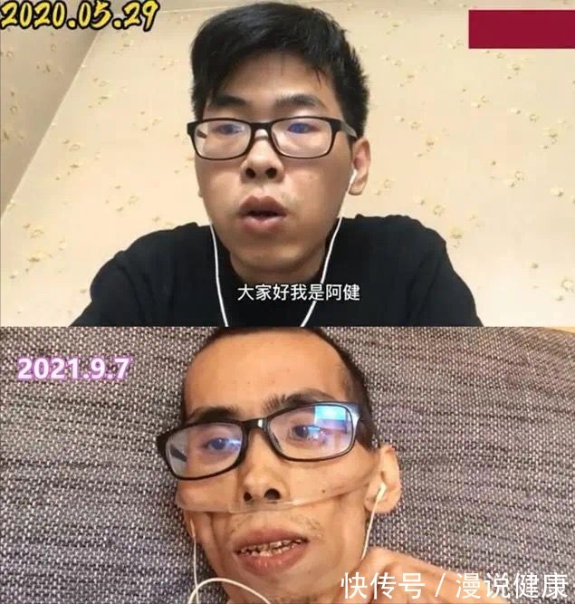 肠癌|抗癌博主阿健病逝:死亡率排名第二!这种癌症开始“盯上”年轻人