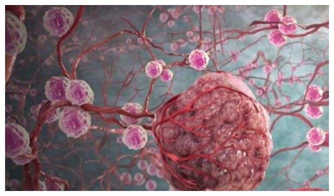 天然|“天然化栓王”被发现了,每天吃上几颗,可能会清肠道、降血栓