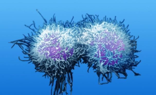 刘女士|颈部突然有三个表现，预示着癌症要来，不要存在侥幸心理！