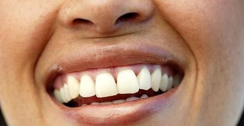 卵巢|女人有没有妇科病,看嘴就能明白,若有表现,十有八九是找上你了