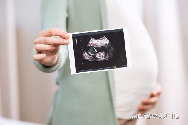 缓解|进入孕晚期,8种常见不适的缓解技巧要了解,尽量轻松等卸货