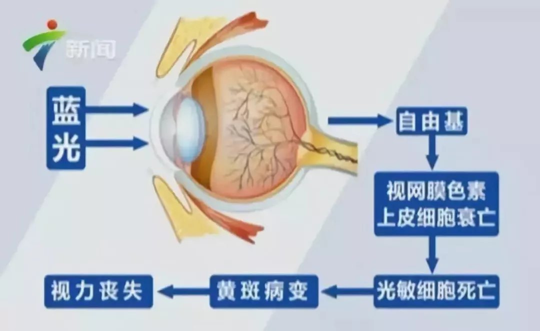 病变|这种眼疾来势汹汹,却被太多人忽视!眼疲劳、视力下降、有小黑点…可能是“致盲”信号!