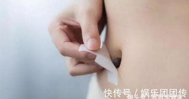 桂圆肉|伏天是补阳、祛痰湿的好时机,这3招,阳虚、痰湿重的人别错过!