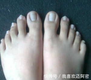 心脏|心脏好的人具有3个“特征”,若你占上一个,你的血管很不错了!